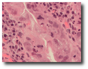 “Last year I had an accident... stupid... lost a thumb.” He shrugged apologetically, “It took almost six months to grow back.” Artwork : micrograph of typical and atypical mitosis courtesy of  and used under a  license.
