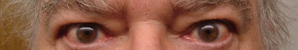 The eyes of Gary Cuba