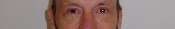 The eyes of Glenn Lewis Gillette