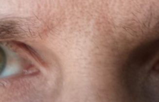 Eyes