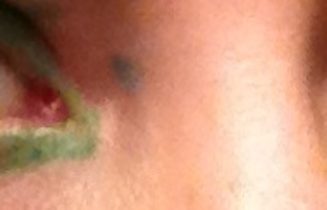 kcnortoneyes